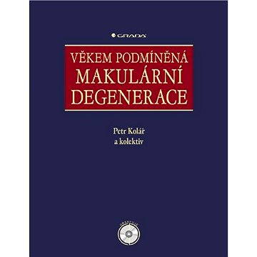 Věkem podmíněná makulární degenerace - Elektronická kniha