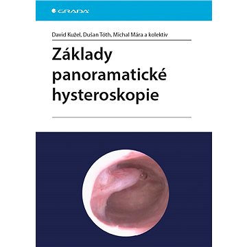 

Základy panoramatické hysteroskopie