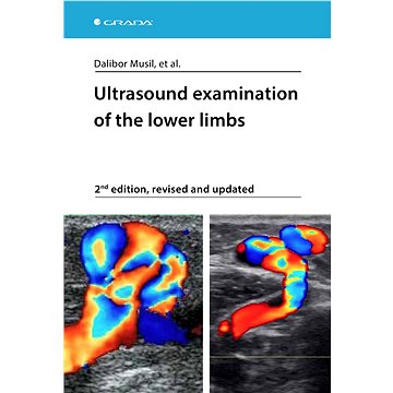 

Ultrasound examination of the lower limbs
