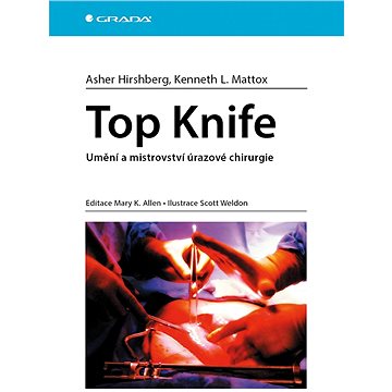 

Top Knife