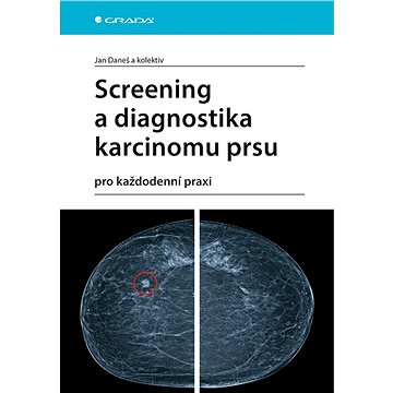 

Screening a diagnostika karcinomu prsu