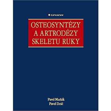 

Osteosyntézy a artrodézy skeletu ruky