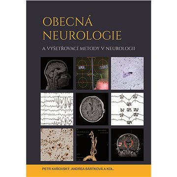 

Obecná neurologie a vyšetřovací metody v neurologii