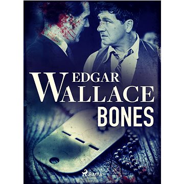 

Bones