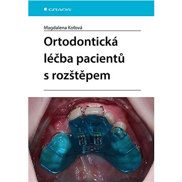 

Ortodontická léčba pacientů s rozštěpem