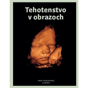 

Tehotenstvo v obrazoch