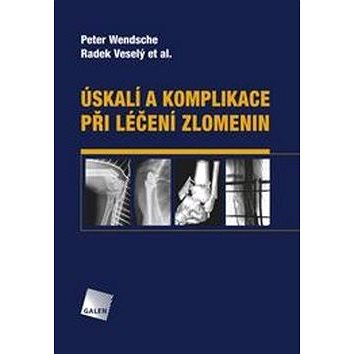 

Úskalí a komplikace při léčení zlomenin