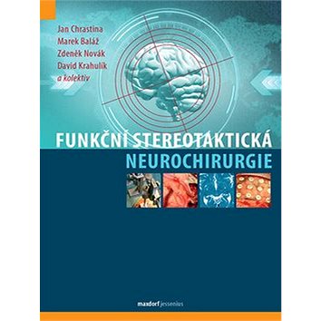 

Funkční stereotaktická neurochirurgie