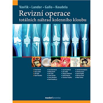 

Revizní operace totálních náhrad kolenního kloubu