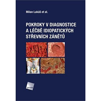 

Pokroky v diagnostice a léčbě idiopatických střevních zánětů