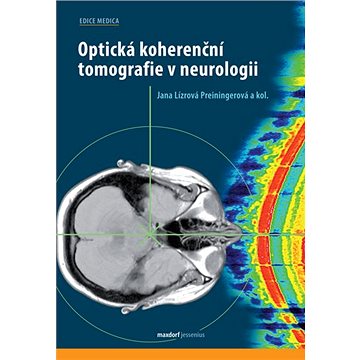

Optická koherenční tomografie v neurologii