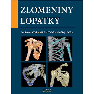

Zlomeniny lopatky