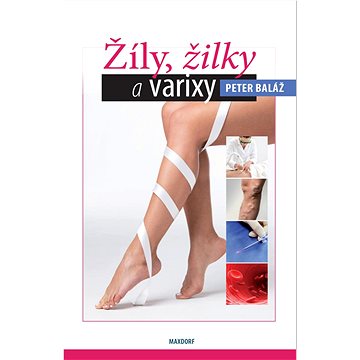 

Žíly, žilky, varixy