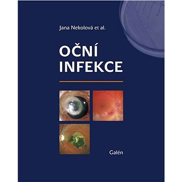 

Oční infekce