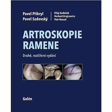 

Artroskopie ramene