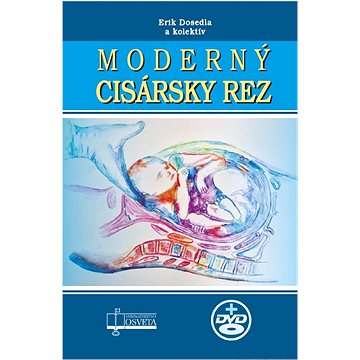 Moderný cisársky rez