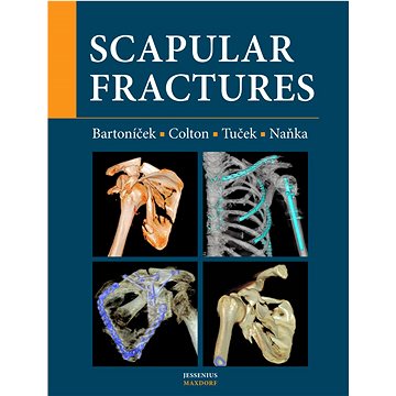 

Scapular fractures