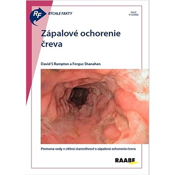 

Rýchle fakty: Zápalové ochorenie čreva