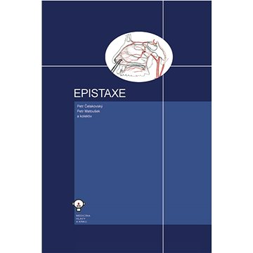 

Epistaxe