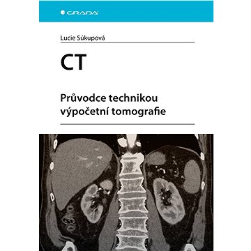 

CT: Průvodce technikou výpočetní tomografie