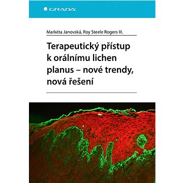 

Terapeutický přístup k orálnímu lichen planus - nové trendy, nová řešení