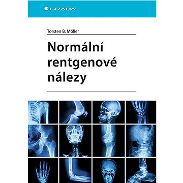 

Normální rentgenové nálezy
