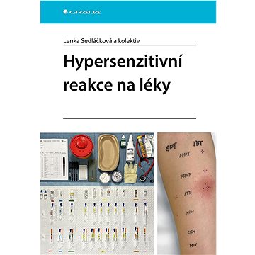 

Hypersenzitivní reakce na léky
