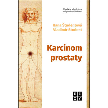

Karcinom prostaty
