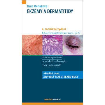 

Ekzémy a dermatitidy: Aktuální téma: Chronický ekzém ruky, Atopický ekzém