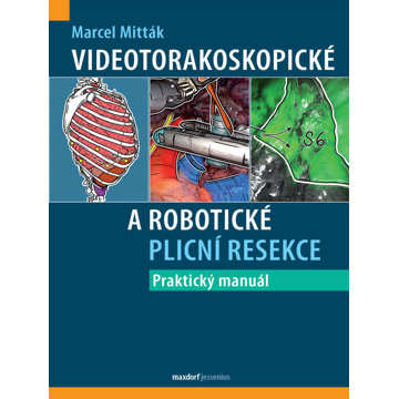

Videotorakoskopické a robotické plicní resekce: Praktický manuál
