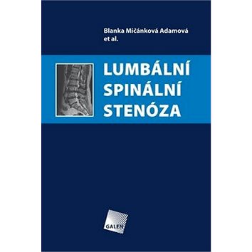 

Lumbální spinální stenóza