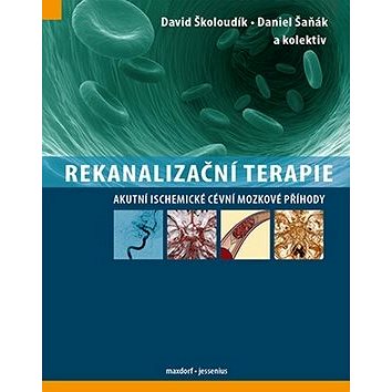 

Rekanalizační terapie: Akutní ischemické cévní mozkové příhody