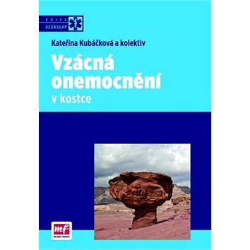

Vzácná onemocnění v kostce