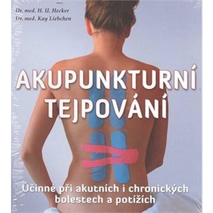 

Akupunkturní tejpování: Účinné při akutních i chronických bolestech a potížích