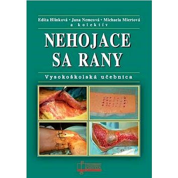 

Nehojace sa rany: Vysokoškolská učebnica
