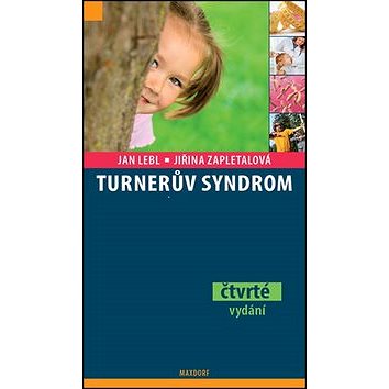 

Turnerův syndrom