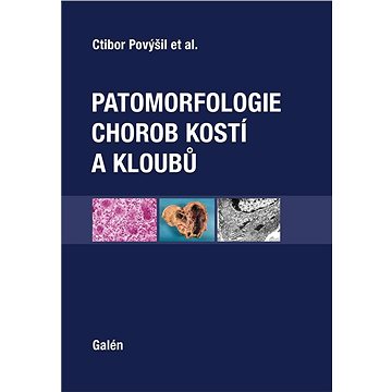 

Patomorfologie chorob kostí a kloubů