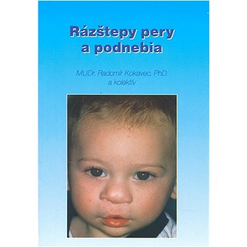 

Rázštepy pery a podnebia