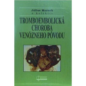 

Tromboembolická choroba venózneho pôvodu