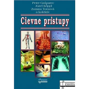 

Cievne prístupy