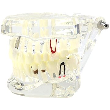 

Verk 01964 Model zubních implantátů bílá