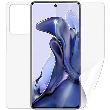 

Screenshield XIAOMI 11T na celé tělo