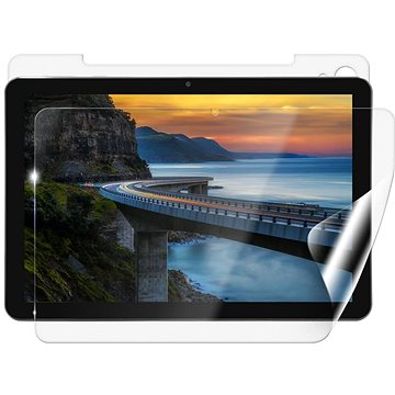 

Screenshield IGET Smart W30 fólie na celé tělo