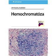 Hemochromatóza - Elektronická kniha