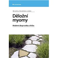 Děložní myomy - Elektronická kniha