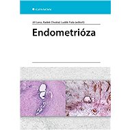 Endometrióza - Elektronická kniha