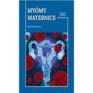 Myómy maternice - Kniha