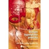 Benigní hyperplazie prostaty - rady pacientům - Vladislav Jarolím