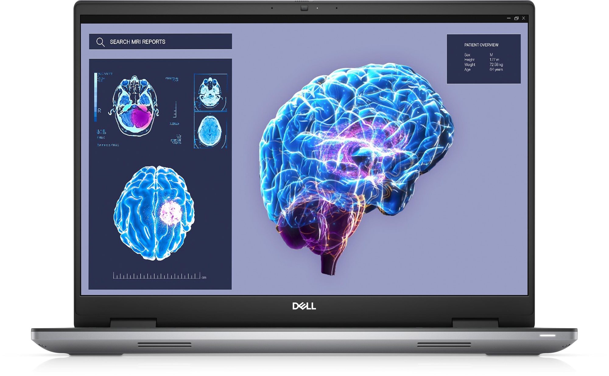 Dell XFYNN Laptop