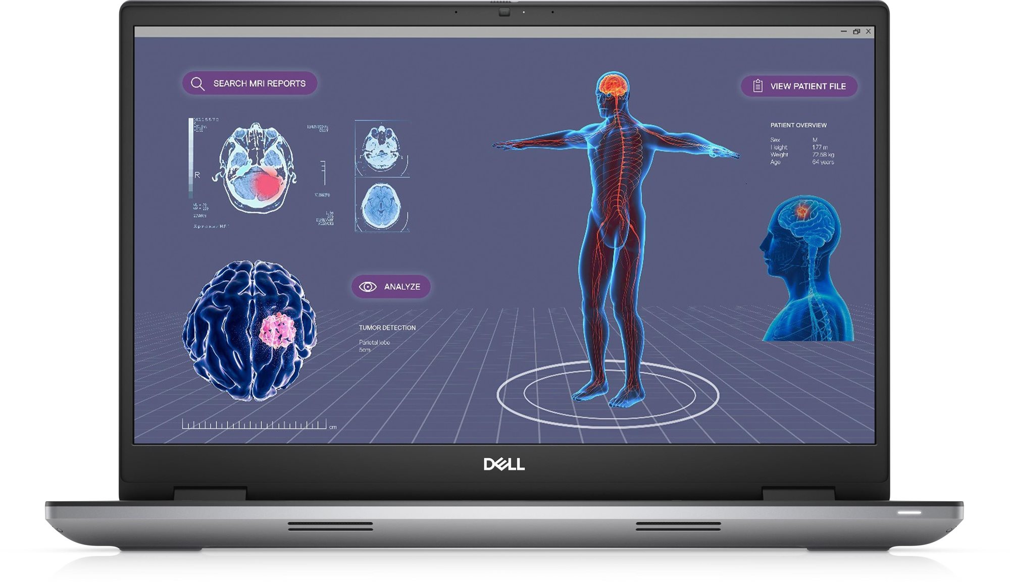 Dell MXNW9 Laptop